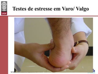 Testes de estresse em Varo/ Valgo

www.otaviomelo.com.br

 