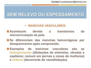  Acontecem devido a transtornos da
microcirculação da pele.
 Se diferenciam das manchas hemorrágicas por
desaparecerem após compressão.
 Exemplos de manchas vasculares são as
telangiectasias (dilatações de arteríolas, vênulas e
capilares; comum em pernas e coxas de mulheres)
e eritema (decorrente de vasodilatação).
 MANCHAS VASCULARES:
SEM RELEVO OU ESPESSAMENTO
Dúvidas? lucasfontesenf@hotmail.com
 