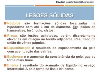  Nódulos são formações sólidas localizadas na
hipoderme com até 3 cm de diâmetro. Ex: lesões da
hanseníase, furúnculo, cistos.
 Placas são lesões achatadas, porém discretamente
elevadas em relação ao tecido adjacente. Resultado da
união de várias pápulas.
 Liquenificação é resultado do espessamento da pele
com acentuação das estrias.
 Esclerose é o aumento da consistência da pele, que se
torna mais firme.
 Edema é resultado do acúmulo de líquido no espaço
intersticial. A pele torna-se lisa e brilhante.
LESÕES SÓLIDAS
Dúvidas? lucasfontesenf@hotmail.com
 