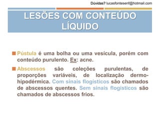  Pústula é uma bolha ou uma vesícula, porém com
conteúdo purulento. Ex: acne.
 Abscessos são coleções purulentas, de
proporções variáveis, de localização dermo-
hipodérmica. Com sinais flogísticos são chamados
de abscessos quentes. Sem sinais flogísticos são
chamados de abscessos frios.
LESÕES COM CONTEÚDO
LÍQUIDO
Dúvidas? lucasfontesenf@hotmail.com
 