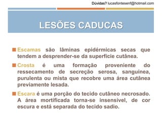 LESÕES CADUCAS
 Escamas são lâminas epidérmicas secas que
tendem a desprender-se da superfície cutânea.
 Crosta é uma formação proveniente do
ressecamento de secreção serosa, sanguínea,
purulenta ou mista que recobre uma área cutânea
previamente lesada.
 Escara é uma porção do tecido cutâneo necrosado.
A área mortificada torna-se insensível, de cor
escura e está separada do tecido sadio.
Dúvidas? lucasfontesenf@hotmail.com
 