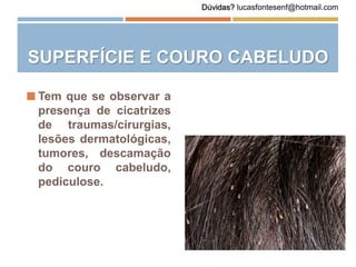 SUPERFÍCIE E COURO CABELUDO
 Tem que se observar a
presença de cicatrizes
de traumas/cirurgias,
lesões dermatológicas,
tumores, descamação
do couro cabeludo,
pediculose.
Dúvidas? lucasfontesenf@hotmail.com
 
