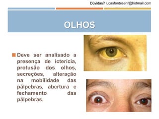 OLHOS
 Deve ser analisado a
presença de icterícia,
protusão dos olhos,
secreções, alteração
na mobilidade das
pálpebras, abertura e
fechamento das
pálpebras.
Dúvidas? lucasfontesenf@hotmail.com
 