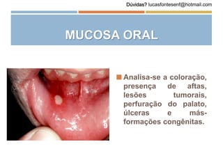 MUCOSA ORAL
 Analisa-se a coloração,
presença de aftas,
lesões tumorais,
perfuração do palato,
úlceras e más-
formações congênitas.
Dúvidas? lucasfontesenf@hotmail.com
 