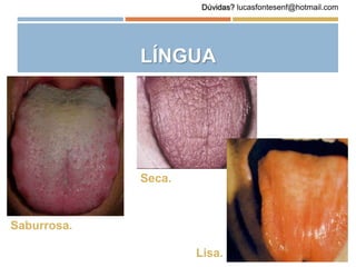 LÍNGUA
Saburrosa.
Seca.
Lisa.
Dúvidas? lucasfontesenf@hotmail.com
 