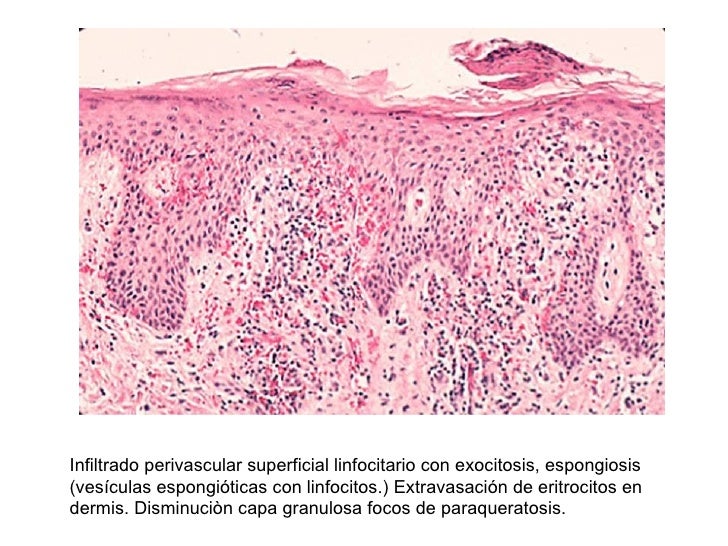 Semiologia Patologia Piel Unal Semiologia Patologia Piel Unal