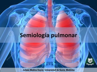 Semiología pulmonar 
Julissa Medina Hoyos, Universidad de Sucre, Medicina 
 
