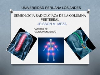 UNIVERSIDAD PERUANA LOS ANDES 
SEMIOLOGIA RADIOLGIACA DE LA COLUMNA 
VERTEBRAL 
JEISSON M. MEZA 
CATEDRA DE 
RADIODIAGNOSTICO 
 