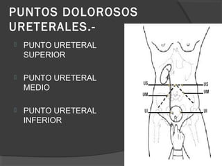 PUNTOS DOLOROSOS
URETERALES.-
PUNTO URETERAL
SUPERIOR
PUNTO URETERAL
MEDIO
PUNTO URETERAL
INFERIOR