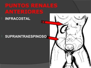 PUNTOS RENALES
ANTERIORES
INFRACOSTAL
SUPRAINTRAESPINOSO