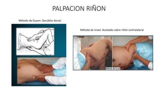 PALPACION RIÑON
Método de Guyon: Decúbito dorsal
Método de Israel: Acostado sobre riñón contralateral
 