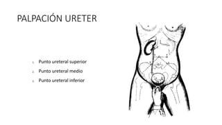 PALPACIÓN URETER
1. Punto ureteral superior
2. Punto ureteral medio
3. Punto ureteral inferior
 