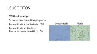 LEUCOCITOS
• VN 0 – 4 x campo
• Si no se procesa a tiempo piuria
• Leucocituria + bacteriuria: ITU
• Leucocituria + cilindros
leucocitarios o hemáticos: GN
 
