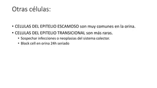 Otras células:
• CELULAS DEL EPITELIO ESCAMOSO son muy comunes en la orina.
• CELULAS DEL EPITELIO TRANSICIONAL son más raras.
• Sospechar infecciones o neoplasias del sistema colector.
• Block cell en orina 24h seriado
 