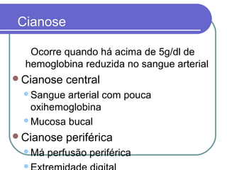 Cianose
Ocorre quando há acima de 5g/dl de
hemoglobina reduzida no sangue arterial
Cianose central
Sangue arterial com pouca
oxihemoglobina
Mucosa bucal
Cianose periférica
Má perfusão periférica

 