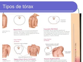 Tipos de tórax
 