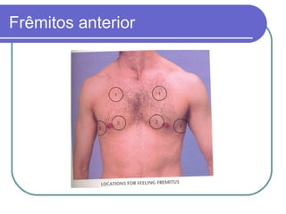 Frêmitos anterior
 