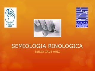 SEMIOLOGIA RINOLOGICA
      DIEGO CRUZ RUIZ
 
