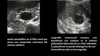 Diagn stico Diferencial En Ultrasonograf a Renal Identificaci n Y diagn-stico-diferencial-en-ultrasonograf-a-renal-identificaci-n-y