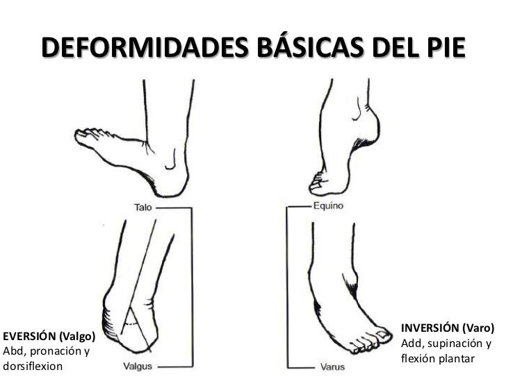 Semiologia tobilllo y pie