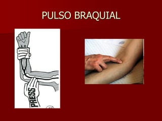 PULSO BRAQUIAL
 