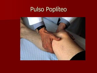 Pulso Poplíteo
 