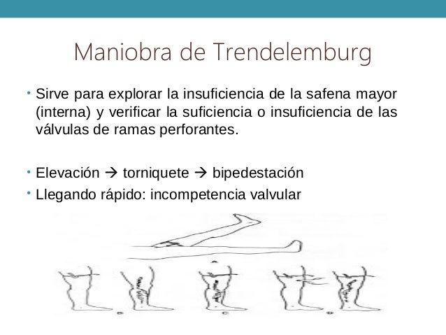 Semiologia vascular y pruebas diagnosticas Semiologia vascular y pruebas diagnosticas