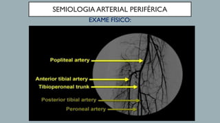 SEMIOLOGIA ARTERIAL PERIFÉRICA
EXAME FÍSICO:
 