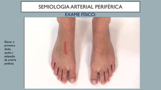 SEMIOLOGIA ARTERIAL PERIFÉRICA
EXAME FÍSICO:
Elevar o
primeiro
dedo,
ajuda a
palpação
da artéria
pediosa
 