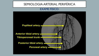 SEMIOLOGIA ARTERIAL PERIFÉRICA
EXAME FÍSICO:
 