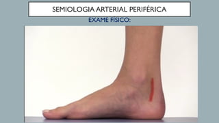 SEMIOLOGIA ARTERIAL PERIFÉRICA
EXAME FÍSICO:
 