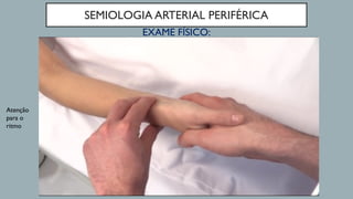 SEMIOLOGIA ARTERIAL PERIFÉRICA
EXAME FÍSICO:
Atenção
para o
ritmo
 