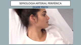 SEMIOLOGIA ARTERIAL PERIFÉRICA
EXAME FÍSICO:
 