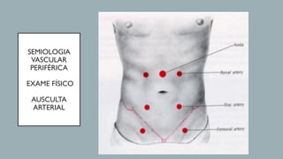 SEMIOLOGIA
VASCULAR
PERIFÉRICA
EXAME FÍSICO
AUSCULTA
ARTERIAL
 