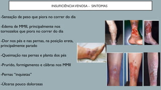 INSUFICIÊNCIAVENOSA - SINTOMAS
-Sensação de peso que piora no correr do dia
-Edema de MMII, principalmente nos
tornozelos que piora no correr do dia
-Dor nos pés e nas pernas, na posição ereta,
principalmente parado
-Queimação nas pernas e planta dos pés
-Prurido, formigamento e cãibras nos MMII
-Pernas “inquietas”
-Úlceras pouco dolorosas
 