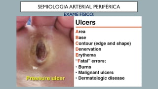 SEMIOLOGIA ARTERIAL PERIFÉRICA
EXAME FÍSICO:
 