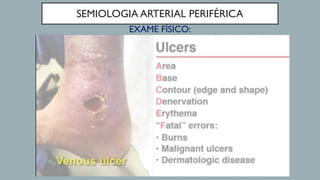 SEMIOLOGIA ARTERIAL PERIFÉRICA
EXAME FÍSICO:
 