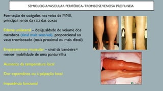 SEMIOLOGIAVASCULAR PERIFÉRICA- TROMBOSEVENOSA PROFUNDA
Formação de coágulos nas veias de MMII,
principalmente da raiz das coxas
Edema unilateral – desigualdade de volume dos
membros (sinal mais sensível), proporcional ao
vaso trombosado (mais proximal ou mais distal)
Empastamento muscular – sinal da bandeira=
menor mobilidade de uma panturrilha
Aumento da temperatura local
Dor espontânea ou à palpação local
Impotência funcional
 