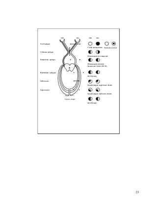 23
OD OG
Nerf o ptique
Chiasma optique
B andelette optique
Radiations o ptiques
Inférieures
Supérieures
Cortex visuel
Cécité mo noculaire Scoto me central
Hémianopsie bi t empo rale
Hémianopsie lat éra le
ho monyme dro it e (HL H)
HL H droit e
Quadra nopsie supérieure droite
Quadra nopsie inférieure droite
HL H droit e
OD OG
 