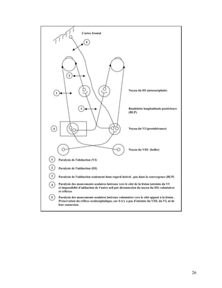 26
5
2
1
3
4
Cortex frontal
Noyau du III (mésencéphale)
Bandelette longitudinale postérieure
(BLP)
Noyau du VI (protubérance)
Noyau du VIII (bulbe)
2
1
3
4
Paralysie de l'abduction (VI)
Paralysie de l'adduction (III)
Paralysie de l'adduction seulement dans regard latéral , pas dans la convergence (BLP)
Paralysie des mouvements oculaires latéraux vers le côté de la lésion (atteinte du VI
et impossibilté d'adduction de l'autre oeil par déconnexion du noyau du III) volontaires
et réflexes
Paralysie des mouvements oculaires latéraux volontaires vers le côté opposé à la lésion .
Préservation du réflexe oculocéphalique, car il n'y a pas d'atteinte du VIII, du VI, ni de
leur connexion.
5
 
