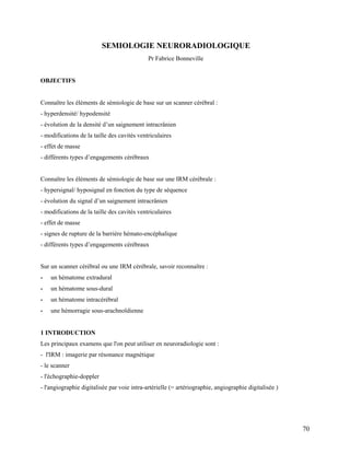 70
SEMIOLOGIE NEURORADIOLOGIQUE
Pr Fabrice Bonneville
OBJECTIFS
Connaître les éléments de sémiologie de base sur un scanner cérébral :
- hyperdensité/ hypodensité
- évolution de la densité d’un saignement intracrânien
- modifications de la taille des cavités ventriculaires
- effet de masse
- différents types d’engagements cérébraux
Connaître les éléments de sémiologie de base sur une IRM cérébrale :
- hypersignal/ hyposignal en fonction du type de séquence
- évolution du signal d’un saignement intracrânien
- modifications de la taille des cavités ventriculaires
- effet de masse
- signes de rupture de la barrière hémato-encéphalique
- différents types d’engagements cérébraux
Sur un scanner cérébral ou une IRM cérébrale, savoir reconnaître :
- un hématome extradural
- un hématome sous-dural
- un hématome intracérébral
- une hémorragie sous-arachnoïdienne
1 INTRODUCTION
Les principaux examens que l'on peut utiliser en neuroradiologie sont :
- l'IRM : imagerie par résonance magnétique
- le scanner
- l'échographie-doppler
- l'angiographie digitalisée par voie intra-artérielle (= artériographie, angiographie digitalisée )
 
