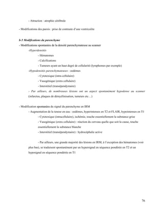 76
- Attraction : atrophie cérébrale
- Modifications des parois : prise de contraste d’une ventriculite
b-5 Modifications du parenchyme
-
- M
Mo
od
di
if
fi
ic
ca
at
ti
io
on
ns
s s
sp
po
on
nt
ta
an
né
ée
es
s d
de
e l
la
a d
de
en
ns
si
it
té
é p
pa
ar
re
en
nc
ch
hy
ym
ma
at
te
eu
us
se
e a
au
u s
sc
ca
an
nn
ne
er
r
-Hyperdensités
- Hématomes
- Calcifications
- Tumeurs ayant un haut degré de cellularité (lymphomes par exemple)
-Hypodensités parenchymateuses : oedèmes
- Cytotoxique (intra cellulaire)
- Vasogénique (extra cellulaire)
- Interstitiel (transépendymaire)
- Par ailleurs, de nombreuses lésions ont un aspect spontanément hypodense au scanner
(infarctus, plaques de démyélinisation, tumeurs etc…)
- Modification s
sp
po
on
nt
ta
an
né
ée
es
s du signal du parenchyme en IRM
- Augmentation de la teneur en eau : oedèmes, hyperintenses en T2 et FLAIR, hypointenses en T1
- Cytotoxique (intracellulaire), ischémie, touche essentiellement la substance grise
- Vasogénique (extra cellulaire) : réaction du cerveau quelle que soit la cause, touche
essentiellement la substance blanche
- Interstitiel (transépendymaire) : hydrocéphalie active
- Par ailleurs, une grande majorité des lésions en IRM, à l’exception des hématomes (voir
plus bas), se traduisent spontanément par un hypersignal en séquence pondérée en T2 et un
hyposignal en séquence pondérée en T1
 