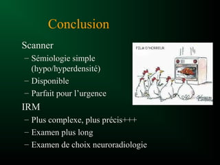 Conclusion
Scanner
– Sémiologie simple
(hypo/hyperdensité)
– Disponible
– Parfait pour l’urgence
IRM
– Plus complexe, plus précis+++
– Examen plus long
– Examen de choix neuroradiologie
 