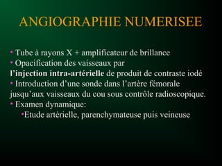 • Tube à rayons X + amplificateur de brillance
• Opacification des vaisseaux par
l’injection intra-artériellel’injection intra-artérielle de produit de contraste iodé
• Introduction d’une sonde dans l’artère fémorale
jusqu’aux vaisseaux du cou sous contrôle radioscopique.
• Examen dynamique:
•Etude artérielle, parenchymateuse puis veineuse
ANGIOGRAPHIE NUMERISEE
 