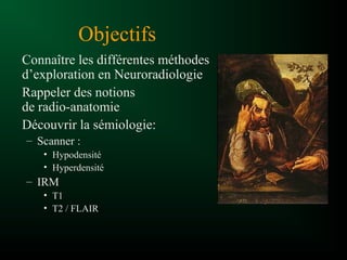 Objectifs
Connaître les différentes méthodes
d’exploration en Neuroradiologie
Rappeler des notions
de radio-anatomie
Découvrir la sémiologie:
– Scanner :
• Hypodensité
• Hyperdensité
– IRM
• T1
• T2 / FLAIR
 