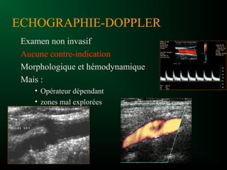 ECHOGRAPHIE-DOPPLER
Examen non invasif
Aucune contre-indication
Morphologique et hémodynamique
Mais :
• Opérateur dépendant
• zones mal explorées
 