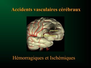 Accidents vasculaires cérébrauxAccidents vasculaires cérébraux
Hémorragiques et Ischémiques
 