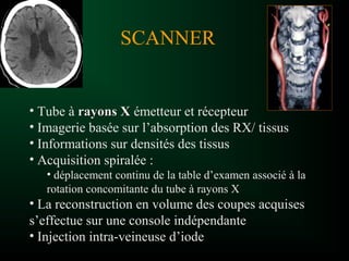 SCANNER
• Tube à rayons Xrayons X émetteur et récepteur
• Imagerie basée sur l’absorption des RX/ tissus
• Informations sur densités des tissus
• Acquisition spiralée :
• déplacement continu de la table d’examen associé à la
rotation concomitante du tube à rayons X
• La reconstruction en volume des coupes acquises
s’effectue sur une console indépendante
• Injection intra-veineuse d’ioded’iode
 