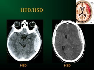 HED/HSD
HED HSD
 