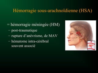 Hémorragie sous-arachnoïdienne (HSA)
= hémorragie méningée (HM)
– post-traumatique
– rupture d’anévrisme, de MAV
– hématome intra-cérébral
souvent associé
 